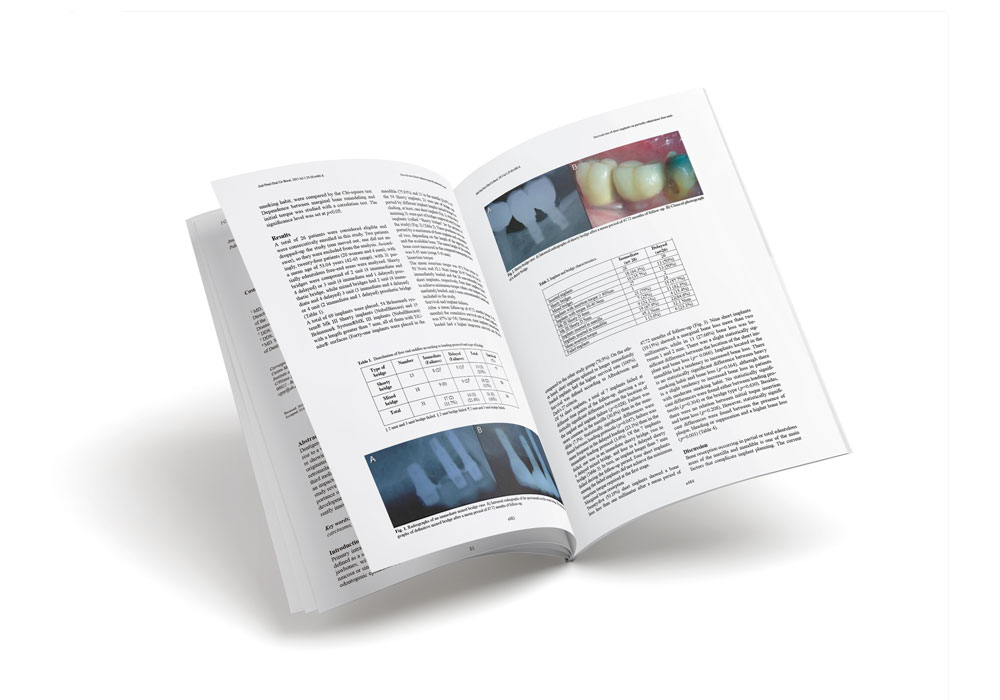 Survival of immediately versus delayed loaded short implants: A prospective case series study